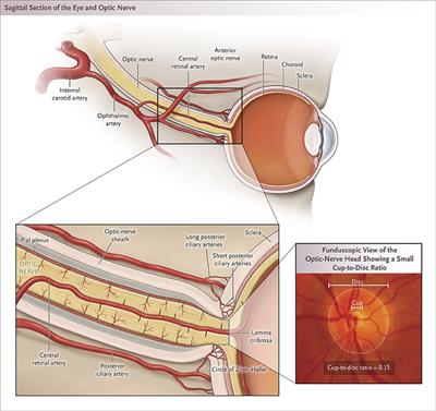 Update on Perioperative Ischemic Optic Neuropathy Associated With Non-ophthalmic Surgery